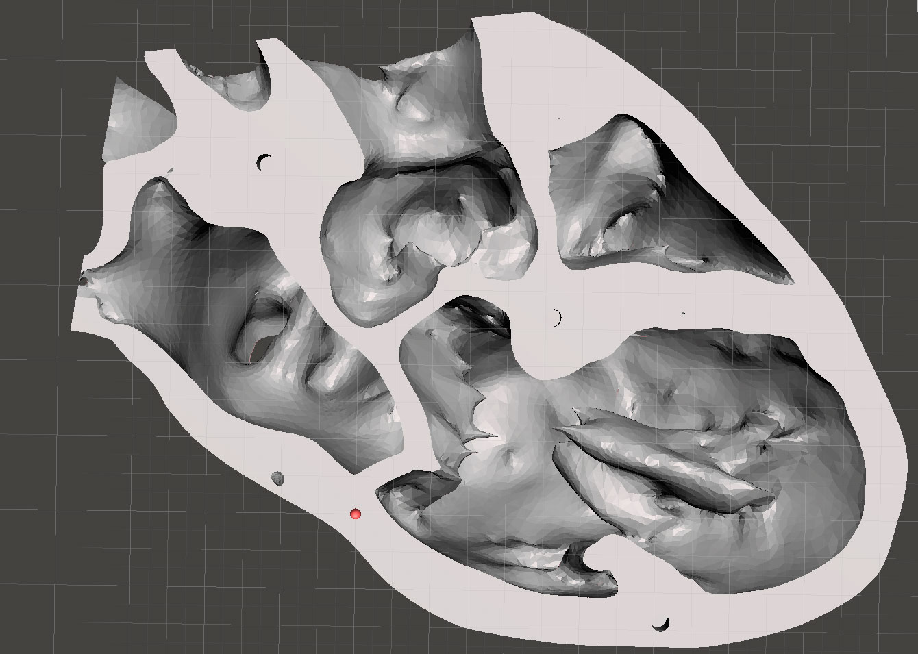 long axis of the heart