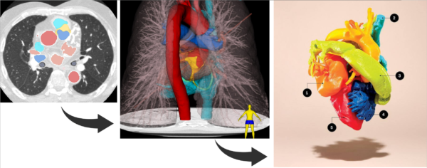 3D Print from CT – Hands-on Course