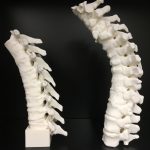 Spine models
for development of neuraxial anesthesia phantomCT. FDM Print.