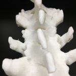 Spine model - Scoliosis
for development of neuraxial anesthesia phantomCT. FDM Print.