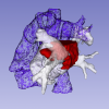 Cardiacl tumor surgical planning model
Interactive rendering of 3D digital model. 3D Slicer. ITK-Snap.